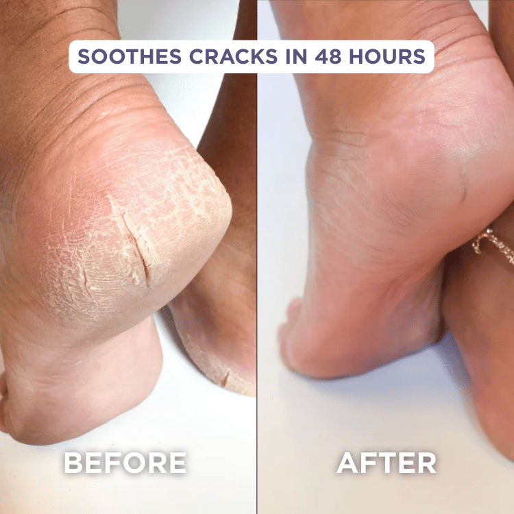 Glaze Essential Foot Balms
