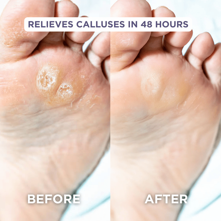 Glaze Essential Foot Balms