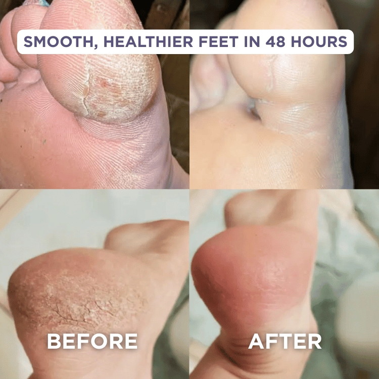 Glaze Essential Foot Balms
