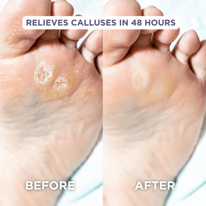 Glaze Essential Foot Balms