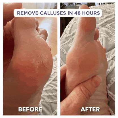 Glaze Essential Foot Balms