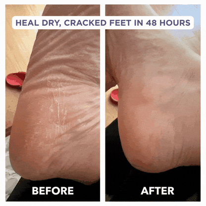 Glaze Essential Foot Balms